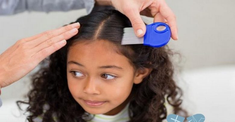 علاج فطريات الشعر عند الاطفال بالاعشاب