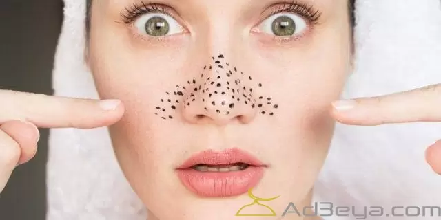 تفسير حلم نقط سوداء في الوجه بالتفصيل