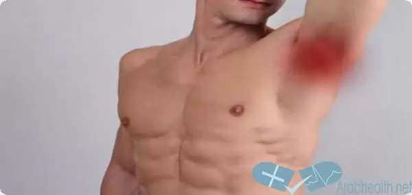 علاج التهاب الغدد الليمفاوية تحت الابط بالاعشاب