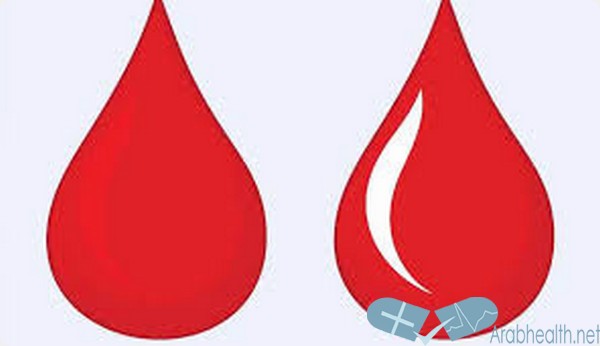 علاج غزارة دم الحيض في المنزل