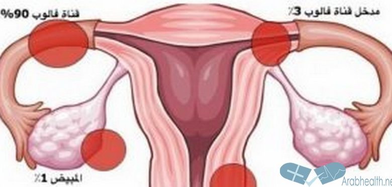 علاج انسداد الانابيب جابر القحطاني بالاعشاب