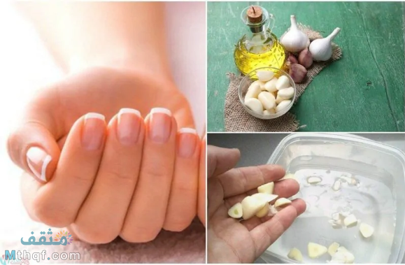 فوائد استخدام الثوم لتطويل الأظافر