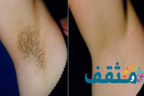 تفسير شعر الابط في في المنام لابن سيرين